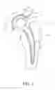 Fig. 02 - Orthopedic device and polymer compositions for making same