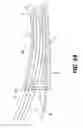 Fig. 19 - PROSTHETIC FOOT WITH SPACED SPRING ELEMENTS