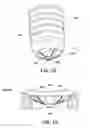 Fig. 12 - Prosthetic socket system
