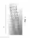 Fig. 02 - BIDIRECTIONAL STENT AND METHOD OF USE THEREOF