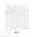 Fig. 03 - BIDIRECTIONAL STENT AND METHOD OF USE THEREOF