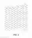 Fig. 05 - BIDIRECTIONAL STENT AND METHOD OF USE THEREOF