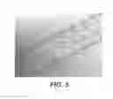 Fig. 06 - BIDIRECTIONAL STENT AND METHOD OF USE THEREOF