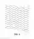 Fig. 07 - BIDIRECTIONAL STENT AND METHOD OF USE THEREOF