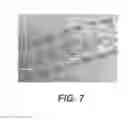 Fig. 08 - BIDIRECTIONAL STENT AND METHOD OF USE THEREOF