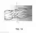 Fig. 16 - BIDIRECTIONAL STENT AND METHOD OF USE THEREOF