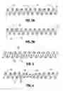 Fig. 03 - DUODENUM SLEEVE FOR TREATING OBESITY