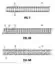 Fig. 04 - DUODENUM SLEEVE FOR TREATING OBESITY