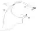 Fig. 01 - SHOULDER INJURY ALERT DEVICE