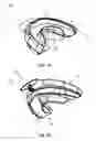 Fig. 02 - ADJUSTABLE BREATHING ASSISTANCE APPARATUS
