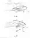 Fig. 08 - ADJUSTABLE BREATHING ASSISTANCE APPARATUS