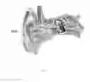 Fig. 02 - Cerumen removal apparatus