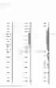 Fig. 11 - Absorbent article with strong and weak bonded portions
