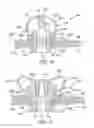 Fig. 08 - Protecting system for containing a biopharmaceutical fluid