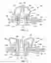 Fig. 09 - Protecting system for containing a biopharmaceutical fluid