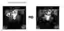 Fig. 01 - BONE REGENERATION PROMOTING COMPOSITION AND BONE REGENERATION PROMOTING APPARATUS