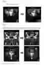 Fig. 02 - BONE REGENERATION PROMOTING COMPOSITION AND BONE REGENERATION PROMOTING APPARATUS