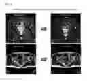 Fig. 04 - BONE REGENERATION PROMOTING COMPOSITION AND BONE REGENERATION PROMOTING APPARATUS