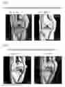 Fig. 06 - BONE REGENERATION PROMOTING COMPOSITION AND BONE REGENERATION PROMOTING APPARATUS