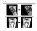 Fig. 07 - BONE REGENERATION PROMOTING COMPOSITION AND BONE REGENERATION PROMOTING APPARATUS