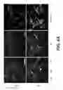 Fig. 07 - Methods and Compositions for the Treatment of Demyelinating Disorders
