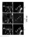 Fig. 09 - Methods and Compositions for the Treatment of Demyelinating Disorders