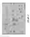 Fig. 22 - Hapten-enhanced chemoimmunotherapy by ultra-minimum incision personalized intratumoral chemoimmunotherapy