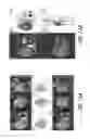 Fig. 32 - Hapten-enhanced chemoimmunotherapy by ultra-minimum incision personalized intratumoral chemoimmunotherapy