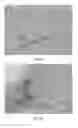 Fig. 06 - COMBINATION THERAPY COMPRISING AN INFLAMMATORY IMMUNOCYTOKINE AND A CHIMERIC ANTIGEN RECEPTOR (CAR)-T CELL
