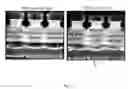 Fig. 03 - Stable formulations for CNS delivery of arylsulfatase A