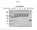 Fig. 04 - Compositions and methods for treatment of homocystinuria