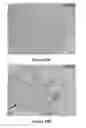 Fig. 22 - Methods, antibodies, and vaccines utilizing epitopes of alpha synuclein for treatment of Parkinson's disease