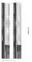 Fig. 67 - METHODS FOR TREATING OR PREVENTING ASTHMA BY ADMINISTERING AN IL-4R ANTAGONIST