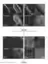 Fig. 31 - DEVICES, SYSTEMS AND METHODS FOR OPTOGENETIC MODULATION OF ACTION POTENTIALS IN TARGET CELLS
