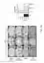Fig. 37 - Methods and compositions for treating metabolic imbalance