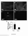 Fig. 09 - Compositions and methods for grafts modified with a non-thrombogenic and pro-migratory cell-derived extracellular matrix