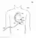 Fig. 01 - BLOOD PUMP