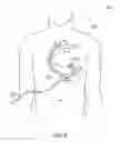 Fig. 07 - BLOOD PUMP