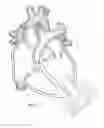 Fig. 08 - Implantable pump system having a coaxial ventricular cannula