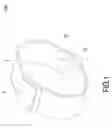 Fig. 02 - Wearable liquid supplying device for human insulin injection
