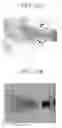 Fig. 33 - Methods for treatment of pulmonary lung diseases with improved therapeutic efficacy and improved dose efficiency