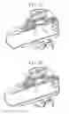 Fig. 09 - Systems and methods comprising a droplet delivery device and a breathing assist device for therapeutic treatment