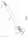 Fig. 03 - Microcatheter and method