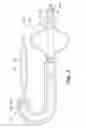 Fig. 04 - STEERING ASSEMBLY FOR INTRAVASCULAR CATHETER SYSTEM
