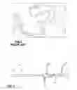 Fig. 02 - SYSTEMS, METHODS, AND DEVICES FOR DELIVERING SUBSTANCES INTO A FALLOPIAN TUBE