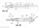 Fig. 09 - SYSTEMS, METHODS, AND DEVICES FOR DELIVERING SUBSTANCES INTO A FALLOPIAN TUBE