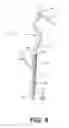 Fig. 07 - Medical systems, devices, and related methods