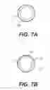 Fig. 08 - Medical systems, devices, and related methods