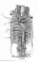 Fig. 03 - Systems and methods for selectively occluding the superior vena cava for treating heart conditions