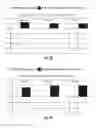 Fig. 16 - Systems and methods for selectively occluding the superior vena cava for treating heart conditions